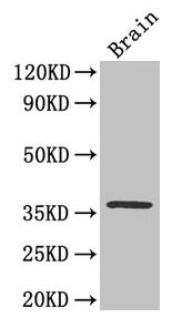 Immunohistochemistry of paraffin-embedded mouse brain tissue using CAC07014 at dilution of 1:50