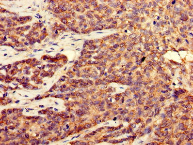Immunofluorescent analysis of PC-3 cells using CAC07024 at dilution of 1:100 and Alexa Fluor 488-congugated AffiniPure Goat Anti-Rabbit IgG(H+L)