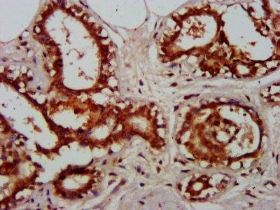 Immunofluorescence staining of PC-3 cells with CAC07031 at 1:200, counter-stained with DAPI. The cells were fixed in 4% formaldehyde, permeabilized using 0.2% Triton X-100 and blocked in 10% normal Goat Serum. The cells were then incubated with the antibody overnight at 4°C. The secondary antibody was Alexa Fluor 488-congugated AffiniPure Goat Anti-Rabbit IgG(H+L).