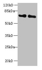 Immunohistochemistry of paraffin-embedded human breast cancer using CAC07039 at dilution of 1:100