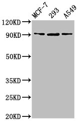 Immunofluorescence staining of Hela cells with CAC07049 at 1:133, counter-stained with DAPI. The cells were fixed in 4% formaldehyde, permeabilized using 0.2% Triton X-100 and blocked in 10% normal Goat Serum. The cells were then incubated with the antibody overnight at 4°C. The secondary antibody was Alexa Fluor 488-congugated AffiniPure Goat Anti-Rabbit IgG(H+L).