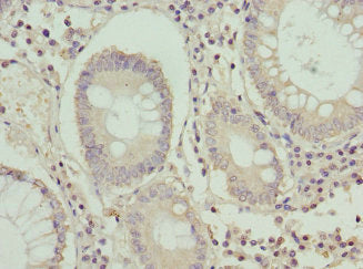 Western blot; ,All lanes: KRAS antibody at 2µg/ml; ,Lane 1: Mouse brain tissue; ,Lane 2: Mouse kidney tissue; ,Secondary; ,Goat polyclonal to rabbit IgG at 1/10000 dilution; ,Predicted band size: 22 kDa; ,Observed band size: 22 kDa