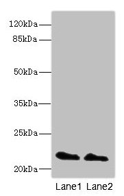 Immunofluorescence staining of Hela cells with CAC07058 at 1:133, counter-stained with DAPI. The cells were fixed in 4% formaldehyde, permeabilized using 0.2% Triton X-100 and blocked in 10% normal Goat Serum. The cells were then incubated with the antibody overnight at 4°C. The secondary antibody was Alexa Fluor 488-congugated AffiniPure Goat Anti-Rabbit IgG(H+L).