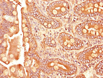 Immunofluorescence staining of HepG2 cells with CAC07073 at 1:400, counter-stained with DAPI. The cells were fixed in 4% formaldehyde, permeabilized using 0.2% Triton X-100 and blocked in 10% normal Goat Serum. The cells were then incubated with the antibody overnight at 4°C. The secondary antibody was Alexa Fluor 488-congugated AffiniPure Goat Anti-Rabbit IgG(H+L).
