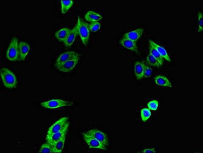 Tgfbr1 Polyclonal Antibody - image 4