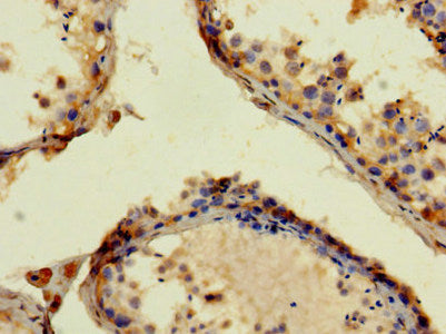 Immunohistochemistry of paraffin-embedded human brain tissue using CAC07117 at dilution of 1:100