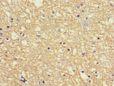 App Polyclonal Antibody - image 5