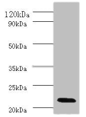 Immunohistochemistry of paraffin-embedded human glioma using CAC07124 at dilution of 1:100