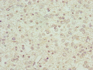 Western Blot; , Positive WB detected in: Mouse stomach tissue; , All lanes: IFN-alpha antibody at 3µg/ml; , Secondary; , Goat polyclonal to rabbit IgG at 1/50000 dilution; , predicted band size: 22 kDa; , observed band size: 22 kDa;