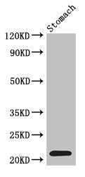 Immunohistochemistry of paraffin-embedded human lung tissue using CAC07124 at dilution of 1:100