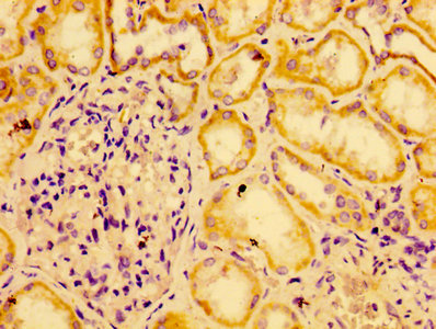 IHC image diluted at 1:1200 and staining in paraffin-embedded human placenta tissue performed on a Leica BondTM system. After dewaxing and hydration, antigen retrieval was mediated by high pressure in a citrate buffer (pH 6.0). Section was blocked with 10% normal goat serum 30min at RT. Then primary antibody (1% BSA) was incubated at 4°C overnight. The primary is detected by a biotinylated secondary antibody and visualized using an HRP conjugated SP system.