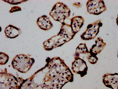 IHC image diluted at 1:1200 and staining in paraffin-embedded human brain tissue performed on a Leica BondTM system. After dewaxing and hydration, antigen retrieval was mediated by high pressure in a citrate buffer (pH 6.0). Section was blocked with 10% normal goat serum 30min at RT. Then primary antibody (1% BSA) was incubated at 4°C overnight. The primary is detected by a biotinylated secondary antibody and visualized using an HRP conjugated SP system.