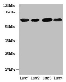 Immunohistochemistry of paraffin-embedded human breast cancer using CAC07157 at dilution of 1:100