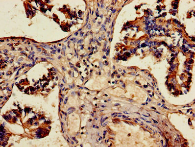 Immunohistochemistry of paraffin-embedded human liver tissue using CAC07162 at dilution of 1:100