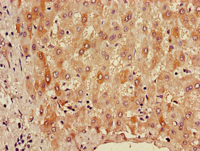 Immunofluorescence staining of A549 cells with CAC07162 at 1:120,counter-stained with DAPI. The cells were fixed in 4% formaldehyde, permeabilized using 0.2% Triton X-100 and blocked in 10% normal Goat Serum. The cells were then incubated with the antibody overnight at 4°C.The secondary antibody was Alexa Fluor 488-congugated AffiniPure Goat Anti-Rabbit IgG (H+L).