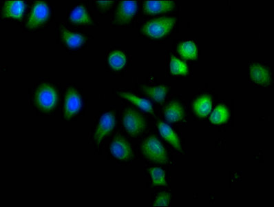 Aldh3A1 Polyclonal Antibody - image 5