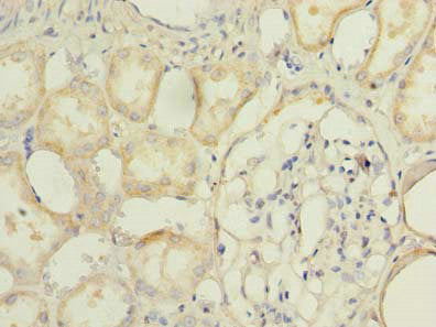 Immunofluorescent analysis of 293T cells using CAC07187 at dilution of 1:100 and Alexa Fluor 488-congugated AffiniPure Goat Anti-Rabbit IgG(H+L)