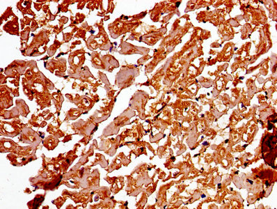 Western Blot; ,Positive WB detected in: Mouse kidney tissue; ,All lanes: ADAMTS4 antibody at 3.2µg/ml; ,Secondary; ,Goat polyclonal to rabbit IgG at 1/50000 dilution; ,Predicted band size: 91 kDa; ,Observed band size: 91 kDa