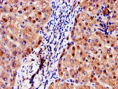 IHC image diluted at 1:250 and staining in paraffin-embedded human lung tissue performed on a Leica BondTM system. After dewaxing and hydration, antigen retrieval was mediated by high pressure in a citrate buffer (pH 6.0). Section was blocked with 10% normal goat serum 30min at RT. Then primary antibody (1% BSA) was incubated at 4°C overnight. The primary is detected by a biotinylated secondary antibody and visualized using an HRP conjugated SP system.