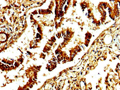 Adamts4 Polyclonal Antibody - image 5