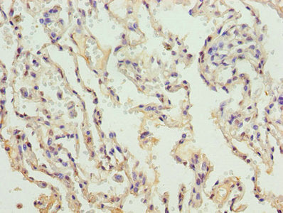 Col4A3 Polyclonal Antibody - image 2