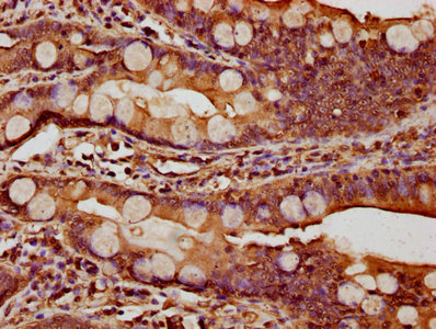 Immunofluorescence staining of Hela cells with CAC07204 at 1:333, counter-stained with DAPI. The cells were fixed in 4% formaldehyde, permeabilized using 0.2% Triton X-100 and blocked in 10% normal Goat Serum. The cells were then incubated with the antibody overnight at 4°C. The secondary antibody was Alexa Fluor 488-congugated AffiniPure Goat Anti-Rabbit IgG(H+L).