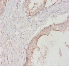 IHC image diluted at 1:400 and staining in paraffin-embedded human skeletal muscle tissue performed on a Leica BondTM system. After dewaxing and hydration, antigen retrieval was mediated by high pressure in a citrate buffer (pH 6.0). Section was blocked with 10% normal goat serum 30min at RT. Then primary antibody (1% BSA) was incubated at 4°C overnight. The primary is detected by a biotinylated secondary antibody and visualized using an HRP conjugated SP system.