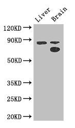 Immunohistochemistry of paraffin-embedded human kidney tissue using CAC07256 at dilution of 1:100