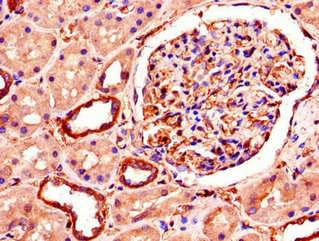 Immunohistochemistry of paraffin-embedded human testis tissue using CAC07256 at dilution of 1:100