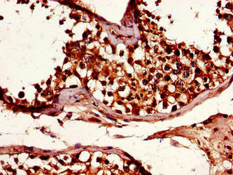 Immunofluorescent analysis of Hela cells using CAC07256 at dilution of 1:100 and Alexa Fluor 488-congugated AffiniPure Goat Anti-Rabbit IgG(H+L)