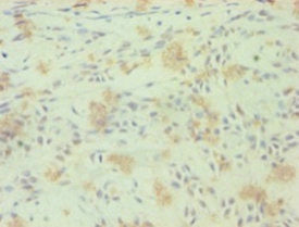 Western Blot; ,Positive WB detected in: HepG2 whole cell lysate; ,All lanes: RORC antibody at 5.2µg/ml; ,Secondary; ,Goat polyclonal to rabbit IgG at 1/50000 dilution; ,Predicted band size: 59, 56 kDa; ,Observed band size: 59 kDa
