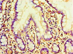 Immunofluorescent analysis of MCF-7 cells using CAC07283 at dilution of 1:100 and Alexa Fluor 488-congugated AffiniPure Goat Anti-Rabbit IgG(H+L)