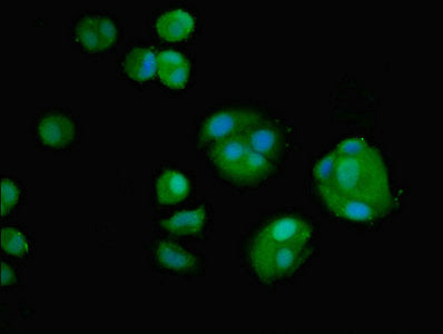 Western Blot; , Positive WB detected in: A549 whole cell lysate; , All lanes: AMH antibody at 2.8µg/ml; , Secondary; , Goat polyclonal to rabbit IgG at 1/50000 dilution; , Predicted band size: 60 kDa; , Observed band size: 60 kDa