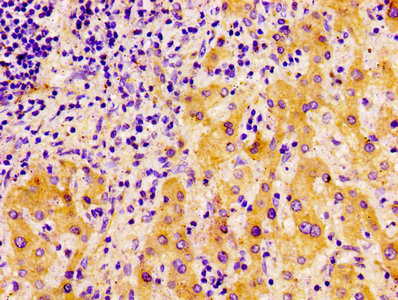 Immunofluorescence staining of Hela cells with CAC07284 at 1:100, counter-stained with DAPI. The cells were fixed in 4% formaldehyde, permeabilized using 0.2% Triton X-100 and blocked in 10% normal Goat Serum. The cells were then incubated with the antibody overnight at 4°C. The secondary antibody was Alexa Fluor 488-congugated AffiniPure Goat Anti-Rabbit IgG(H+L).