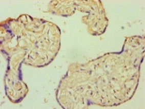 Immunohistochemistry of paraffin-embedded human lung tissue using CAC07299 at dilution of 1:100
