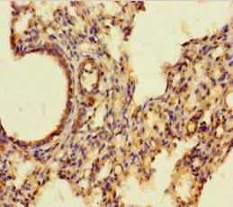 Immunofluorescent analysis of HepG2 cells using CAC07299 at dilution of 1:100 and Alexa Fluor 488-congugated AffiniPure Goat Anti-Rabbit IgG(H+L)