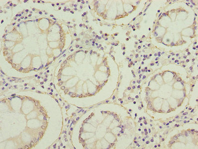 Fabp1 Polyclonal Antibody - image 4
