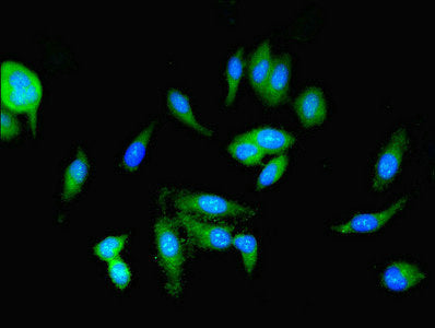Pkm Polyclonal Antibody - image 3