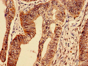 Immunofluorescent analysis of HepG2 cells using CAC07319 at dilution of 1:100 and Alexa Fluor 488-congugated AffiniPure Goat Anti-Rabbit IgG(H+L)