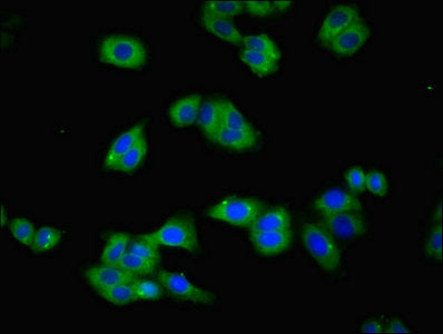 Tfrc Polyclonal Antibody - image 4