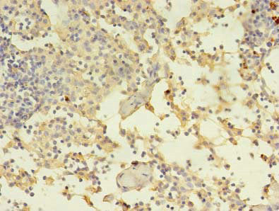 Adam10 Polyclonal Antibody - image 4