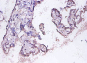 Immunofluorescence staining of MCF-7 cells with CAC07343 at 1:100, counter-stained with DAPI. The cells were fixed in 4% formaldehyde, permeabilized using 0.2% Triton X-100 and blocked in 10% normal Goat Serum. The cells were then incubated with the antibody overnight at 4°C. The secondary antibody was Alexa Fluor 488-congugated AffiniPure Goat Anti-Rabbit IgG(H+L).