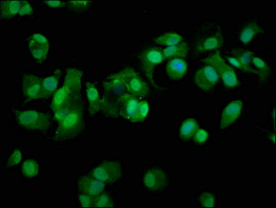 Psmd11 Polyclonal Antibody - image 4