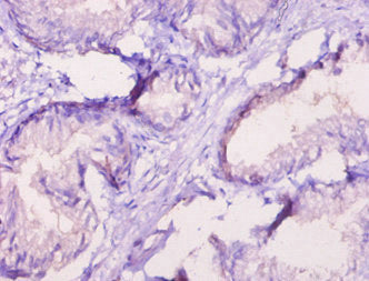 Ror1 Polyclonal Antibody - image 2