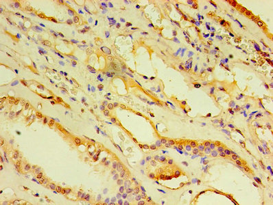 Western Blot; , Positive WB detected in: Hela whole cell lysate; , All lanes: ARF6 antibody at 4.8µg/ml; , Secondary; , Goat polyclonal to rabbit IgG at 1/50000 dilution; , Predicted band size: 21 kDa; , Observed band size: 21 kDa