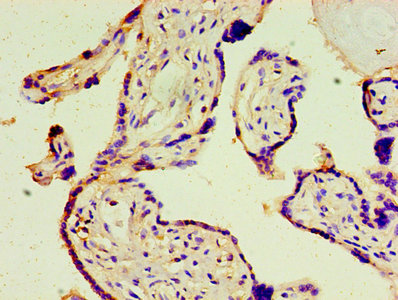 Immunohistochemistry of paraffin-embedded human lung tissue using CAC07411 at dilution of 1:100