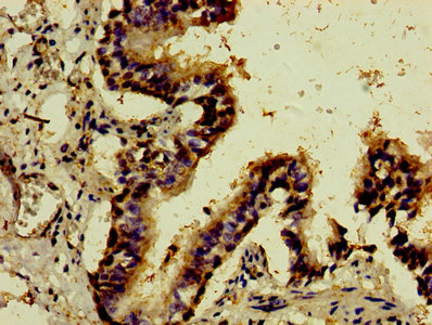 Western Blot; , Positive WB detected in: HEK293 whole cell lysate; , All lanes: ATF3 antibody at 3µg/ml; , Secondary; , Goat polyclonal to rabbit IgG at 1/50000 dilution; , Predicted band size: 21, 14, 16, 13, 15 kDa; , Observed band size: 21 kDa