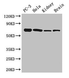 Immunohistochemistry of paraffin-embedded human colon cancer using CAC07415 at dilution of 1:100