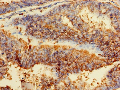 Immunofluorescent analysis of PC-3 cells using CAC07415 at dilution of 1:100 and Alexa Fluor 488-congugated AffiniPure Goat Anti-Rabbit IgG(H+L)