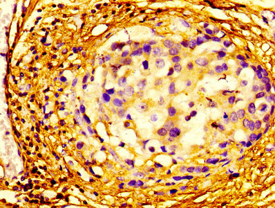 Immunofluorescence staining of A549 cells with CAC07416 at 1:100, counter-stained with DAPI. The cells were fixed in 4% formaldehyde, permeabilized using 0.2% Triton X-100 and blocked in 10% normal Goat Serum. The cells were then incubated with the antibody overnight at 4°C. The secondary antibody was Alexa Fluor 488-congugated AffiniPure Goat Anti-Rabbit IgG(H+L).